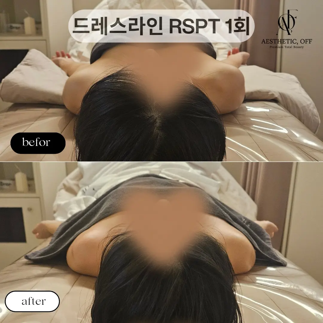 이미지 2