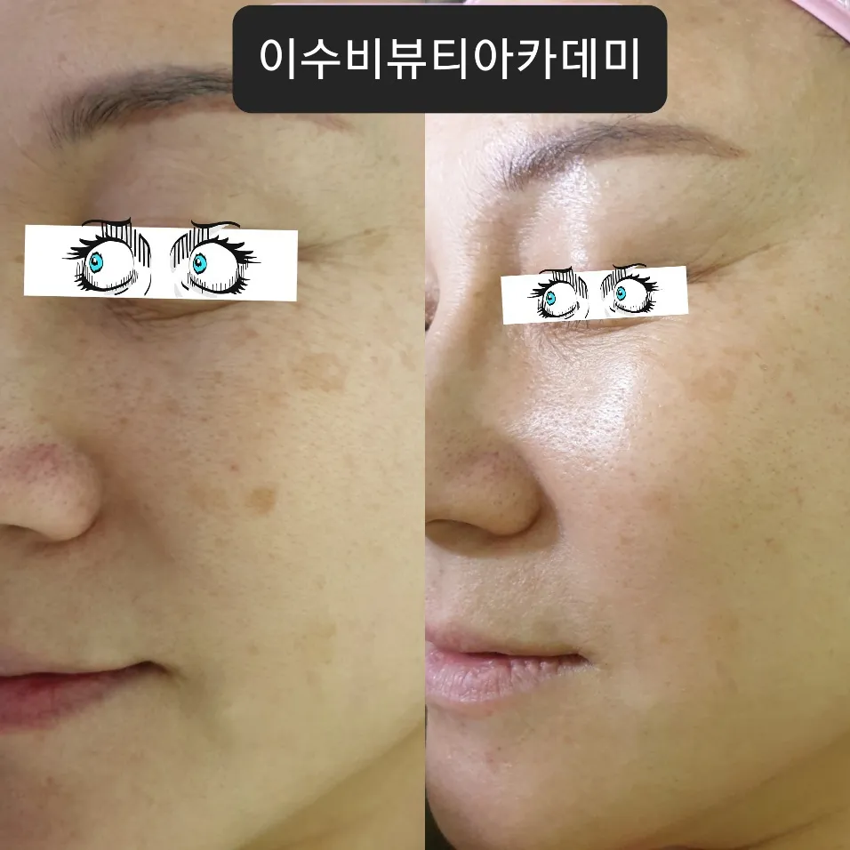 이미지 3