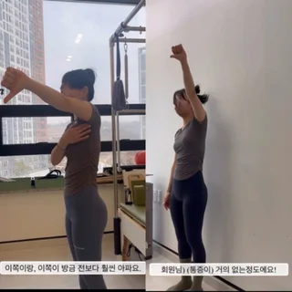 회전근개염, 어깨 통증 - 20대 수영 강사