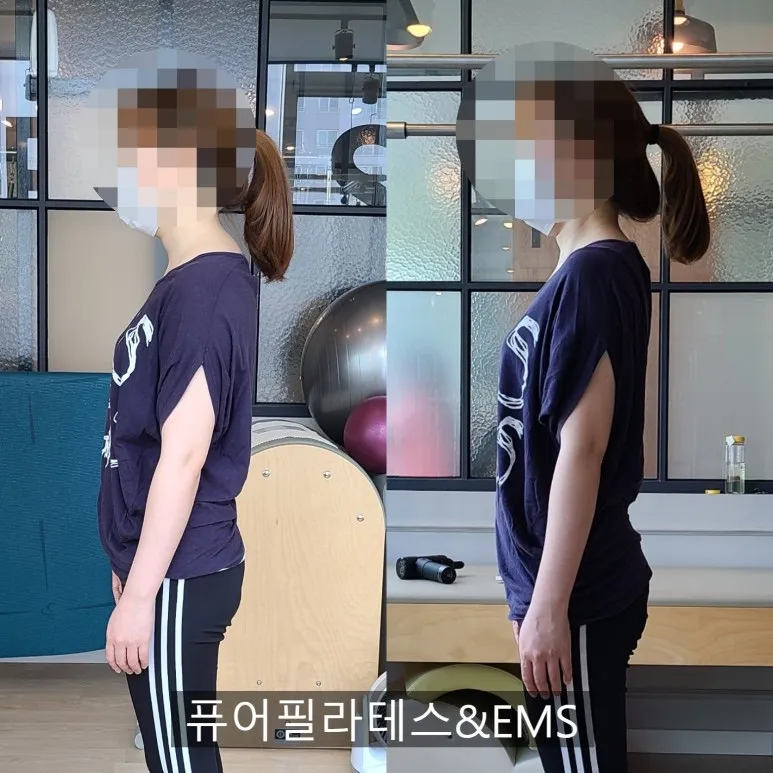 이미지 2