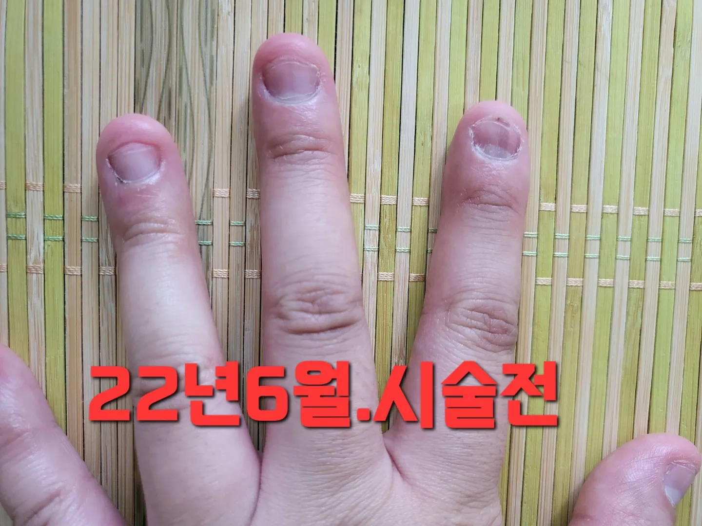 이미지 3