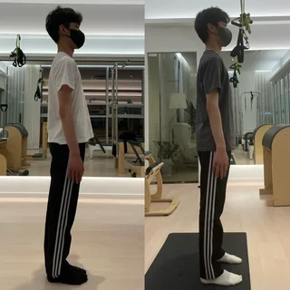 남성 척추측만증