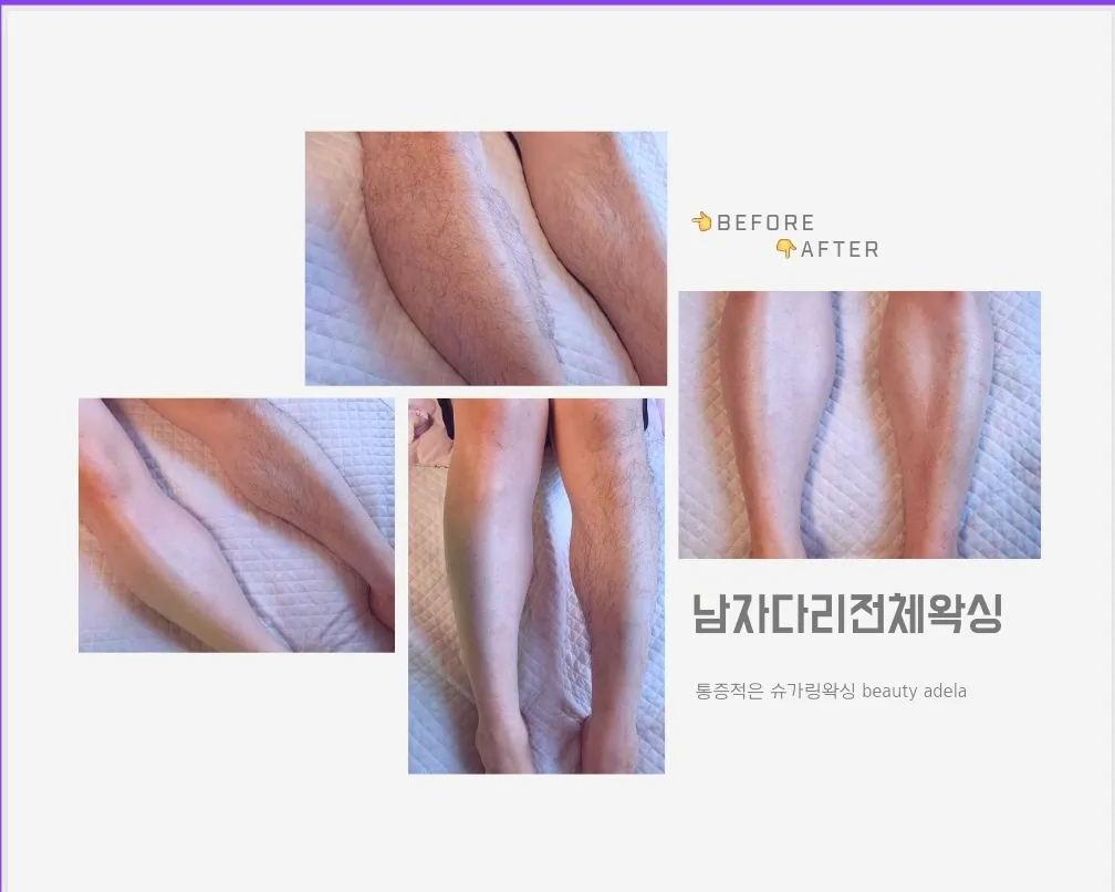 이미지 6