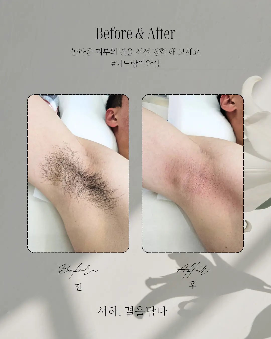 이미지 8