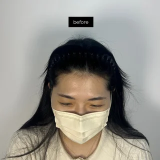 여성 헤어라인