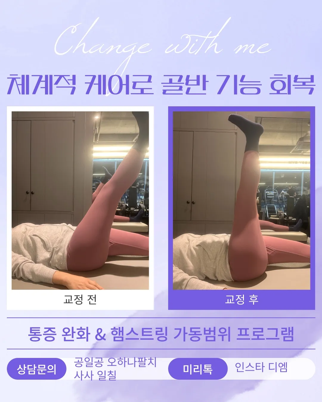 이미지 11