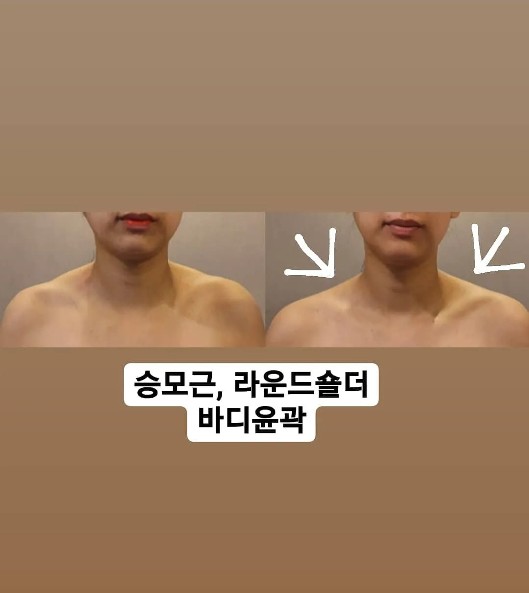 이미지 3