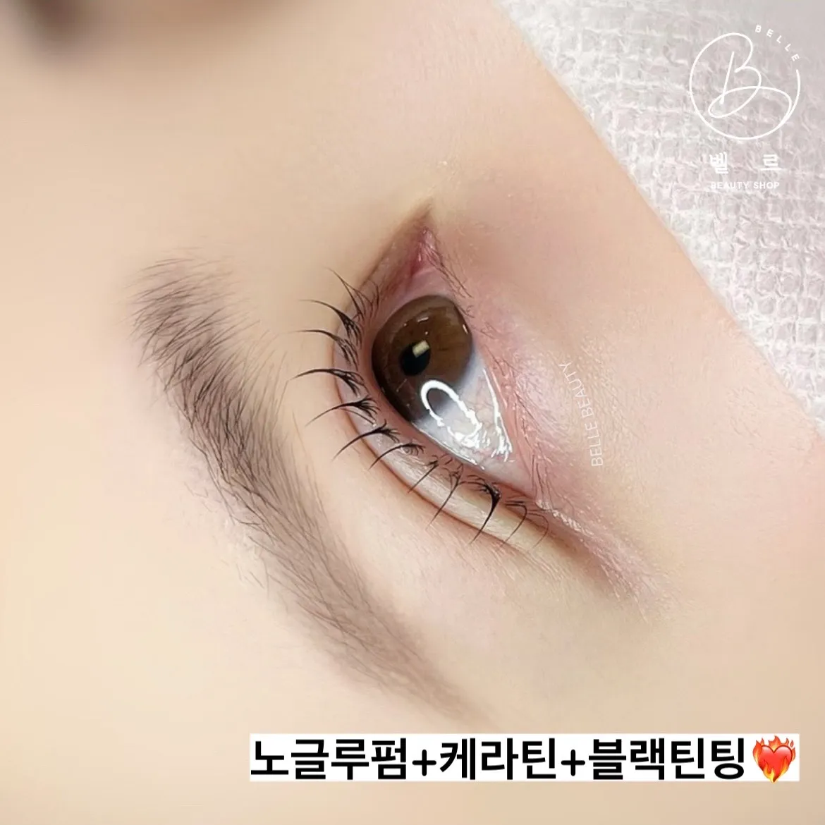 이미지 3