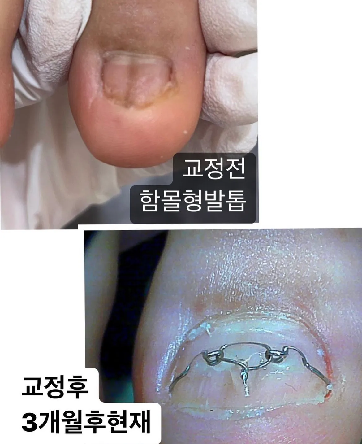 이미지 7