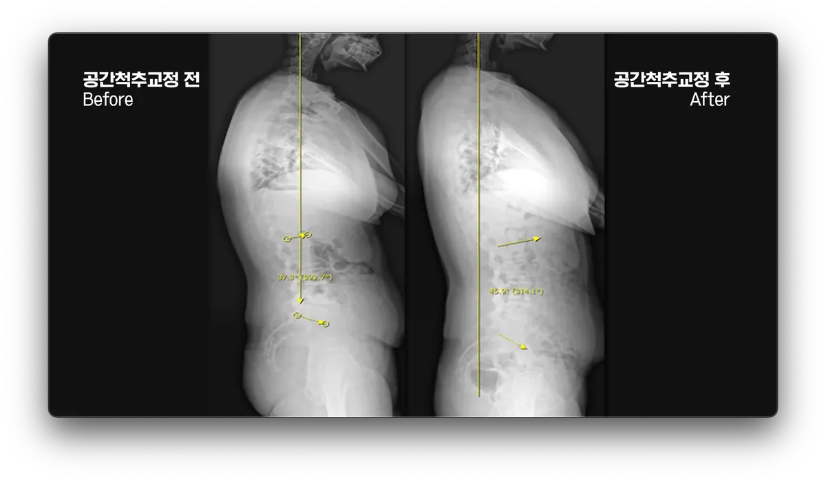 이미지 3