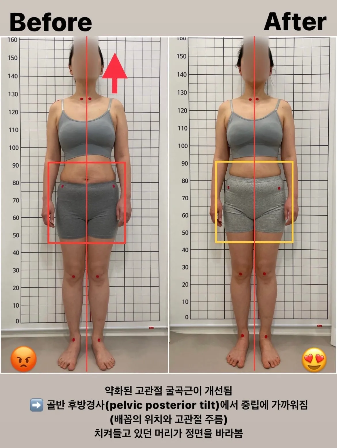 이미지 7