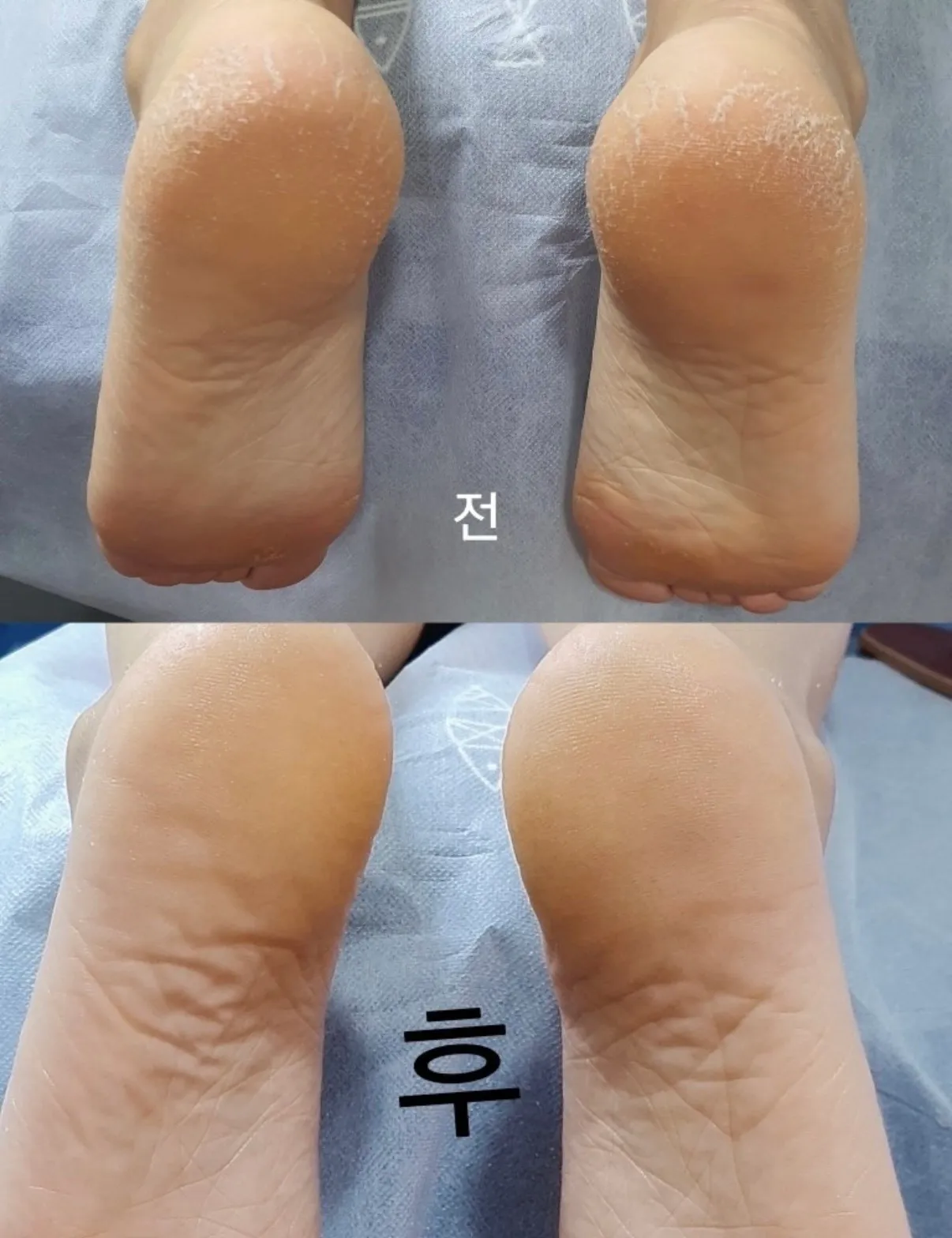 이미지 22