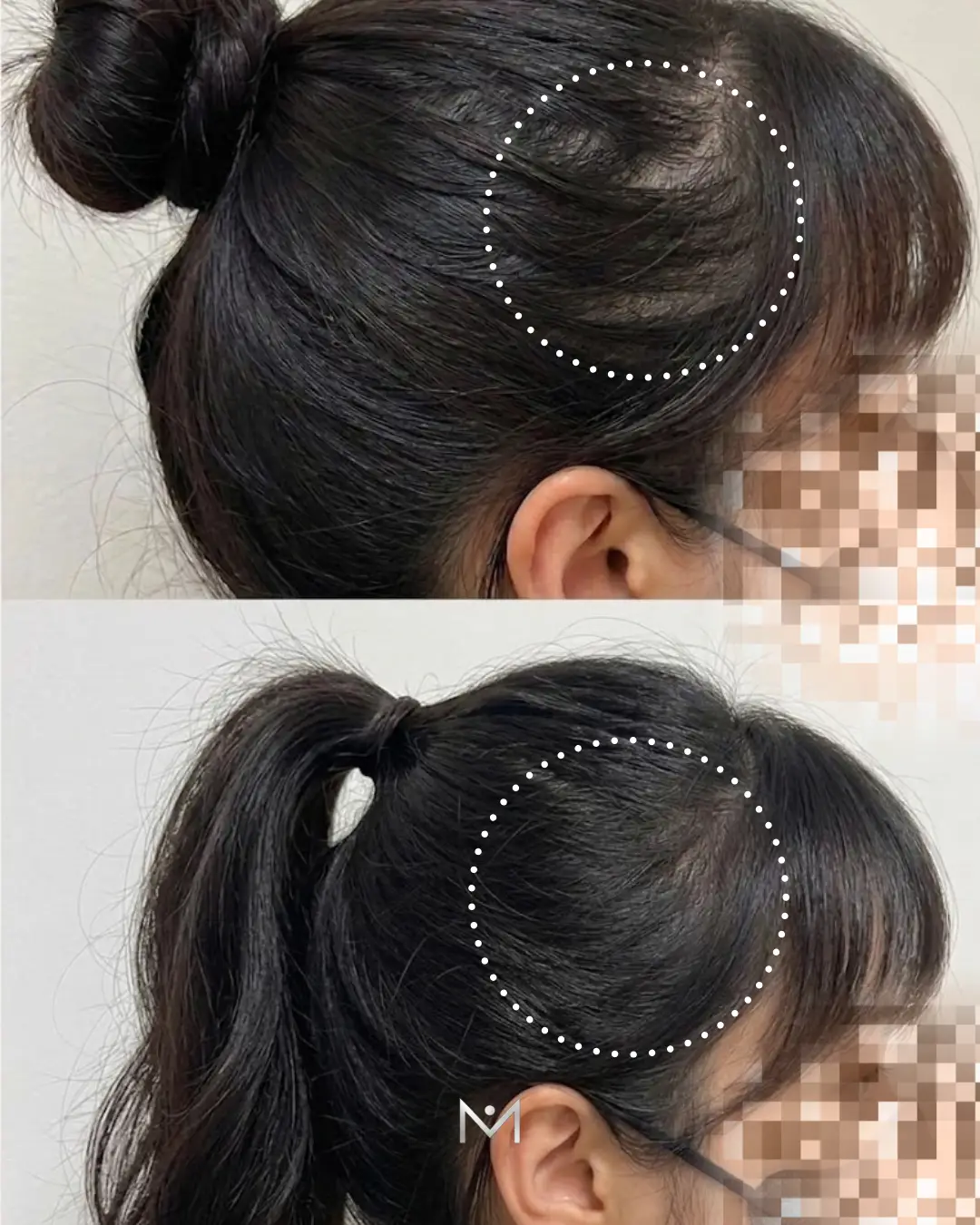 이미지 6