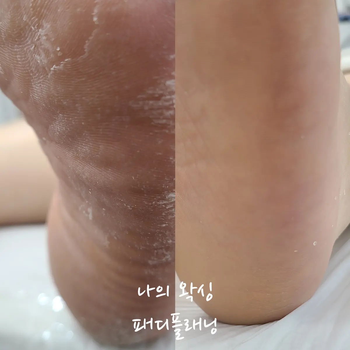 이미지 9