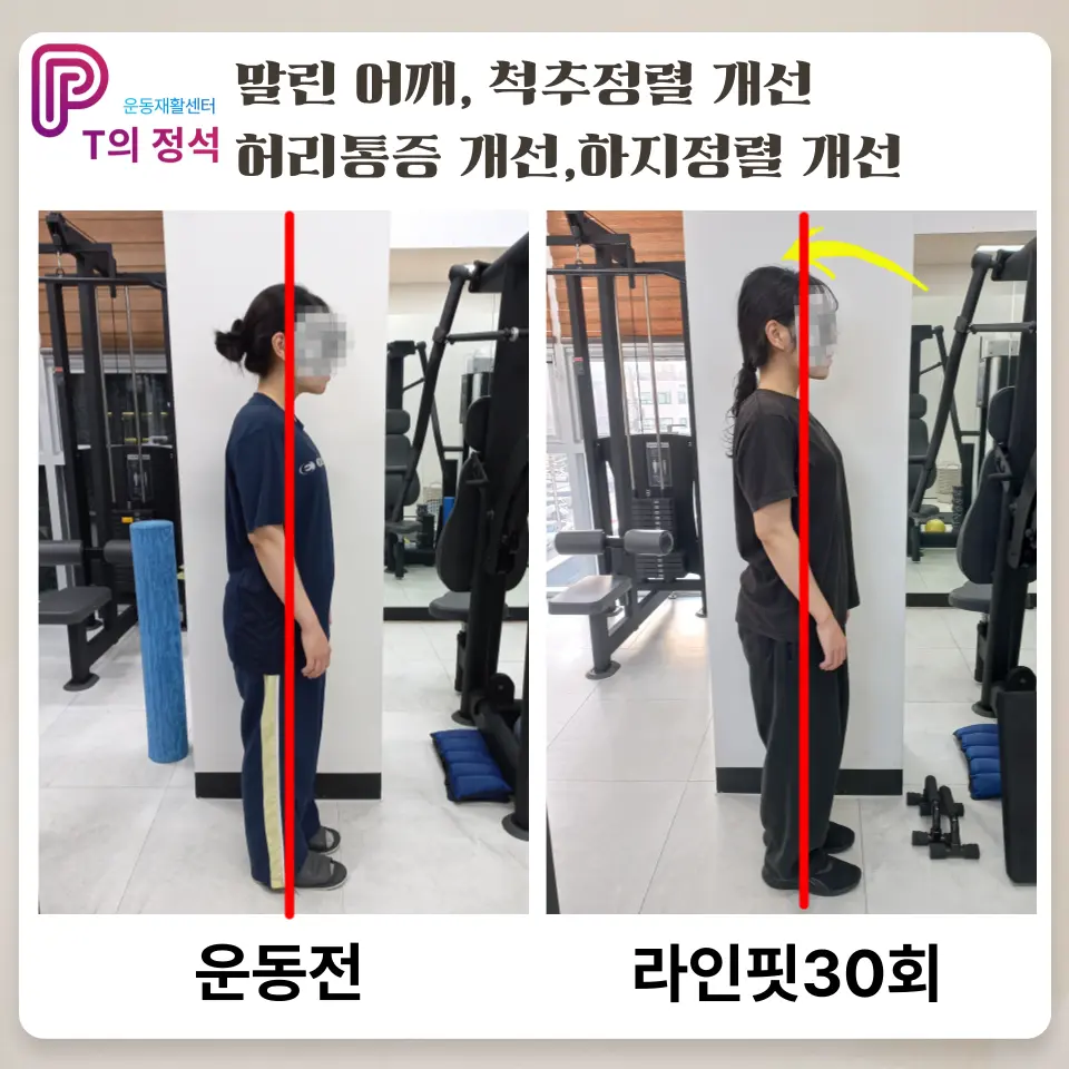 이미지 10