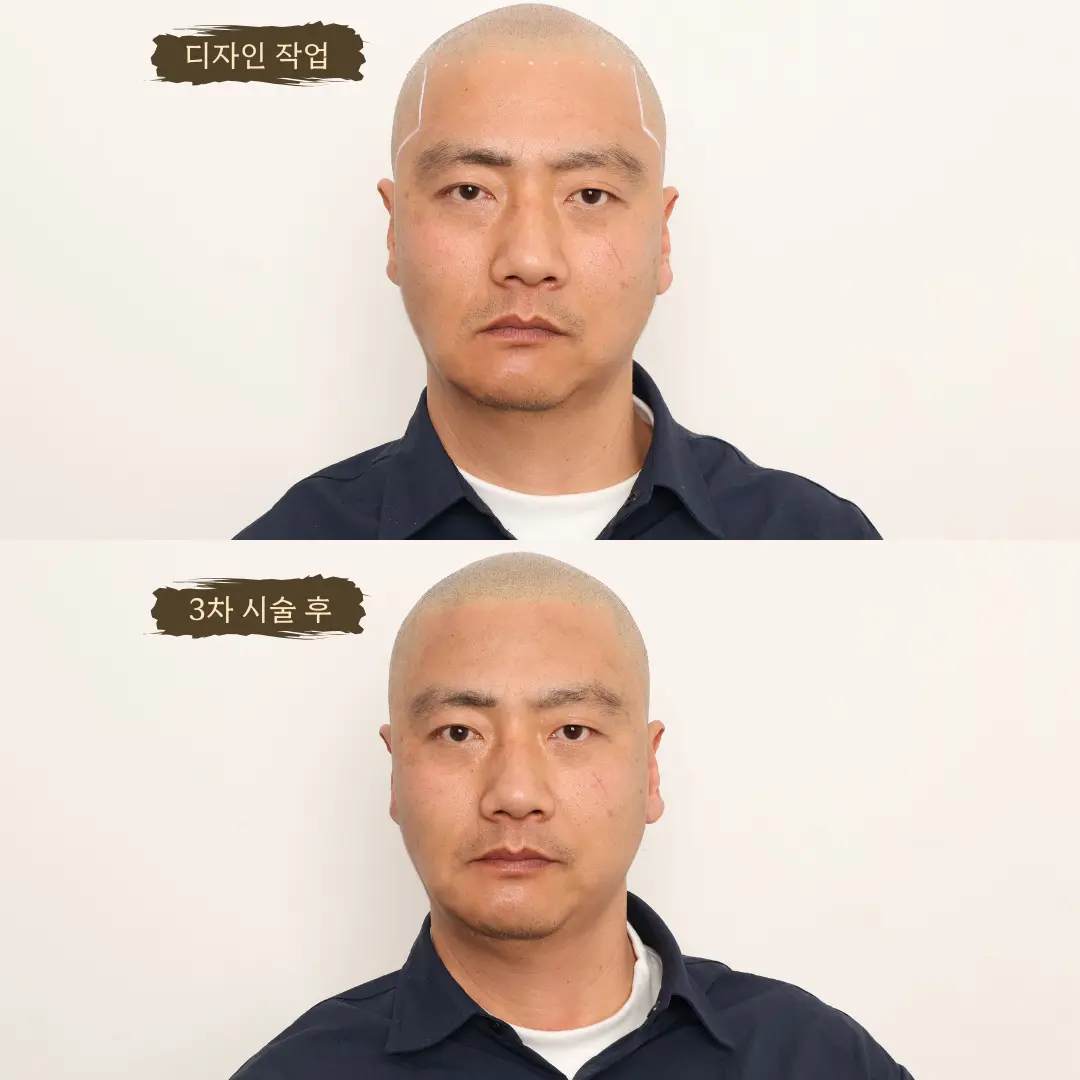 이미지 8