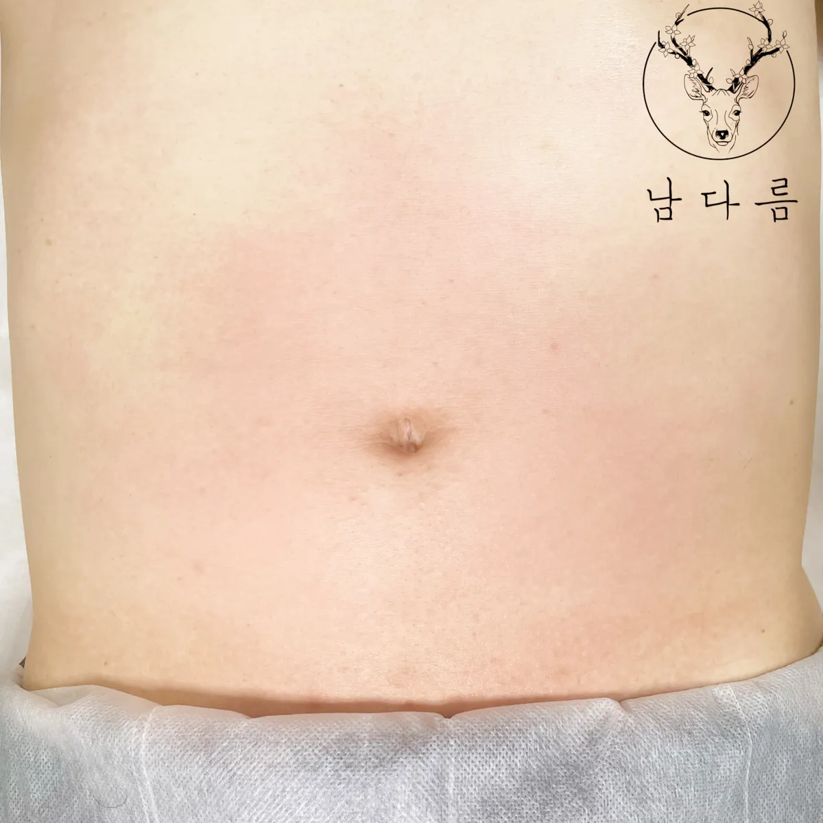 이미지 4