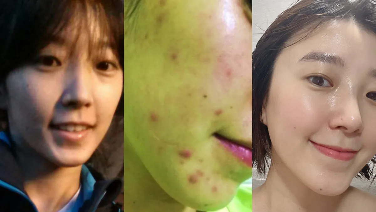 이미지 11