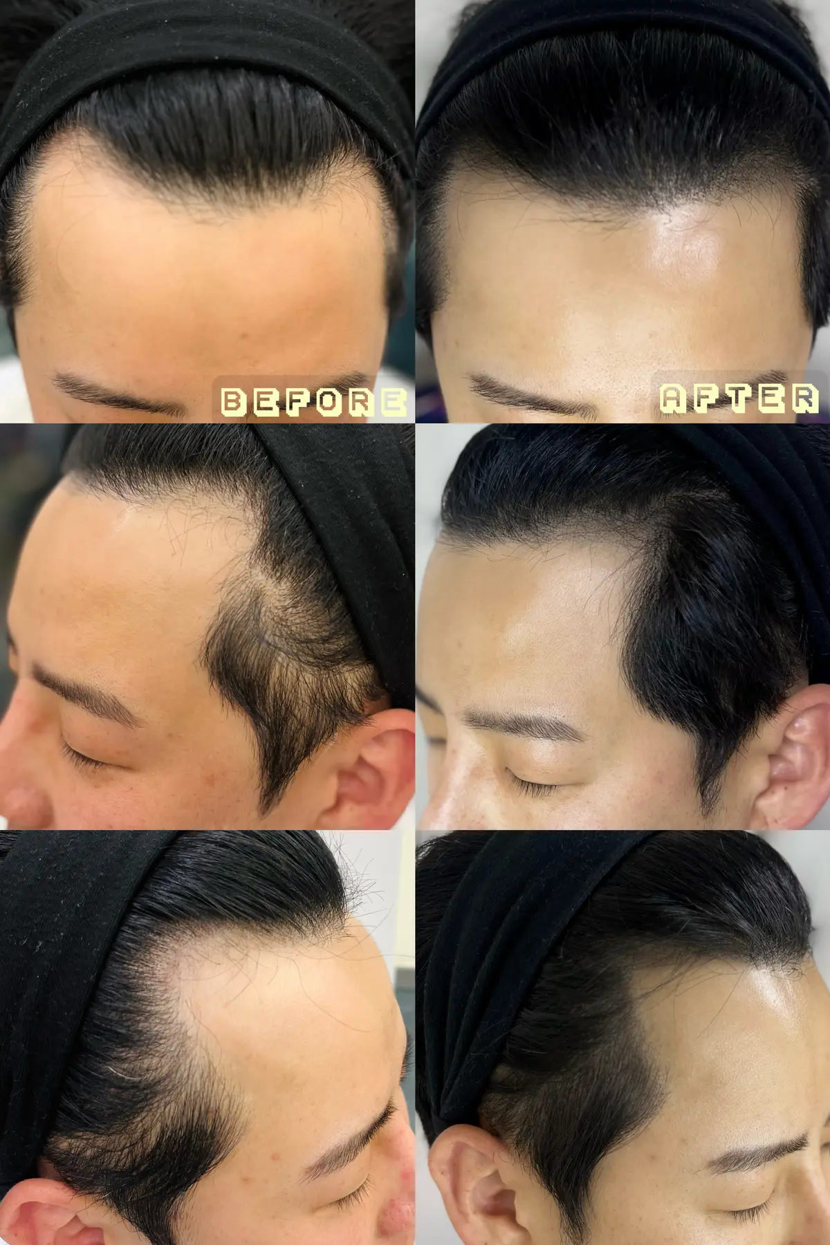 이미지 8