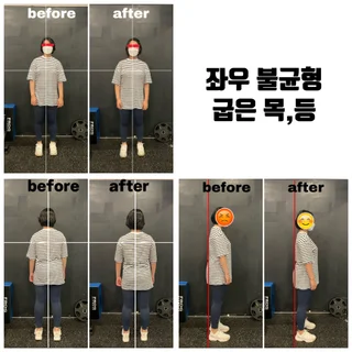 체형교정(어깨 높낮이,굽은등,목)