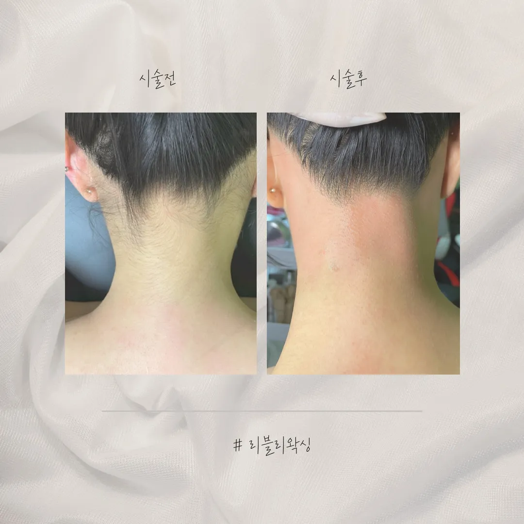 이미지 6