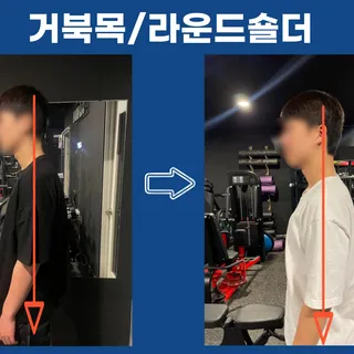 ❗체형교정❗