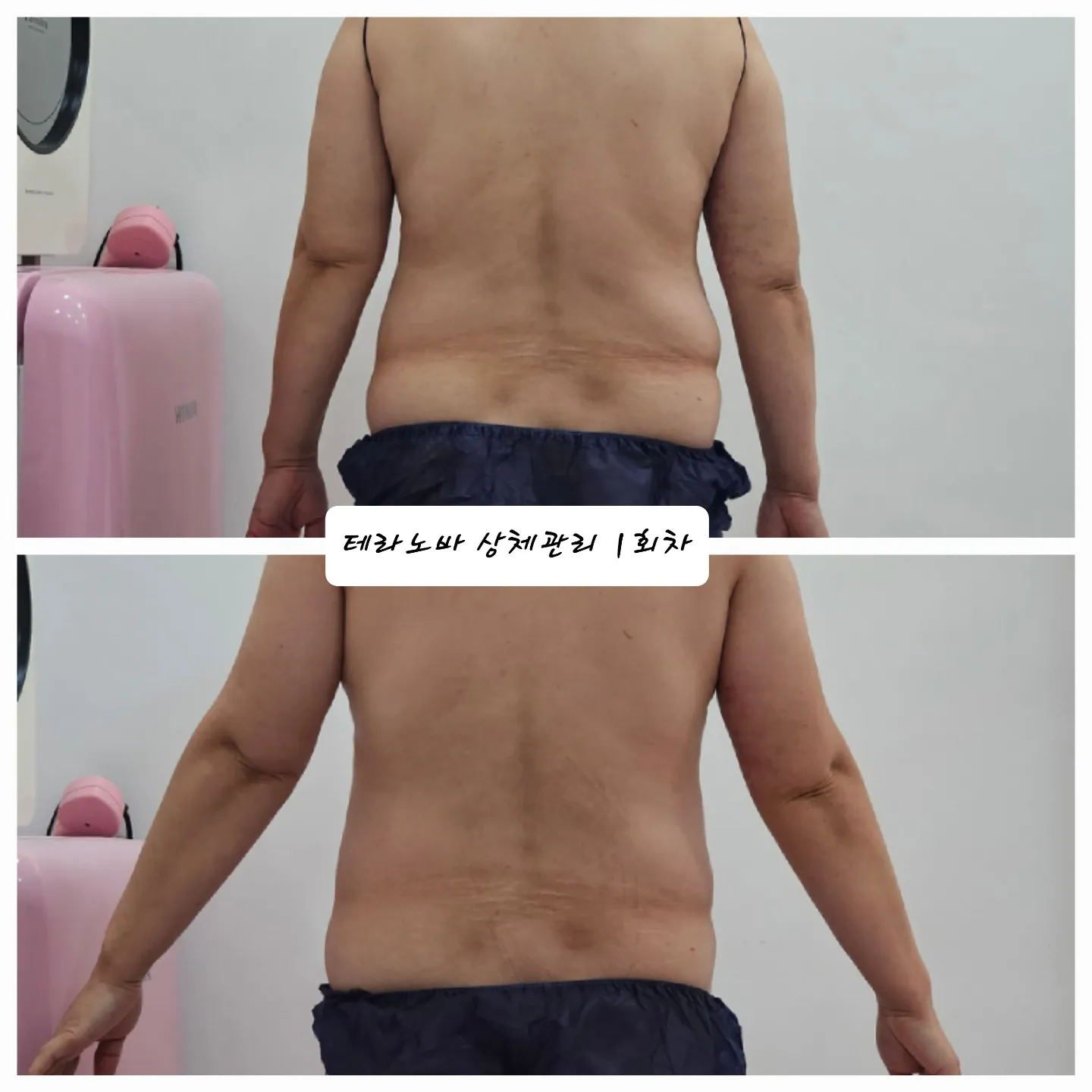이미지 4