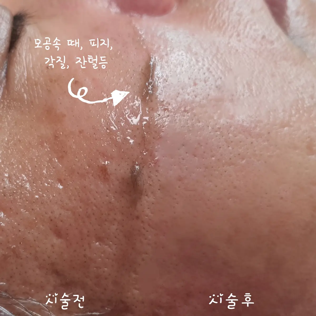 이미지 3