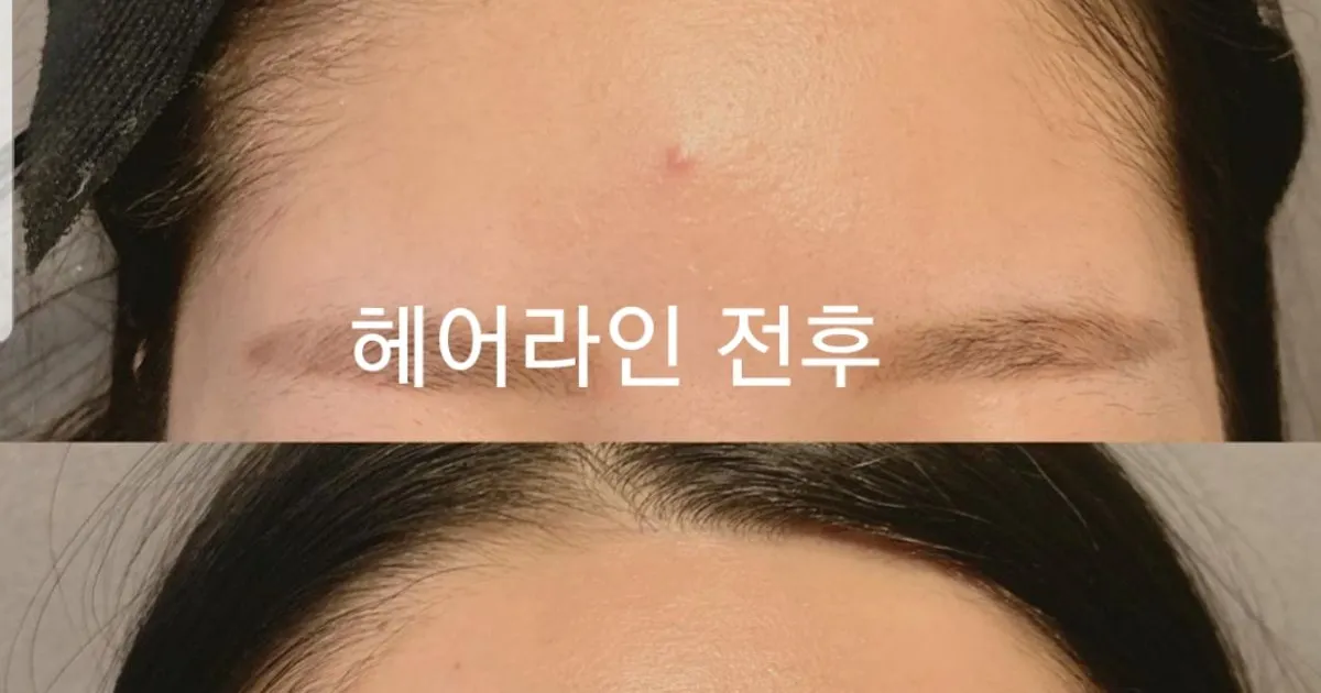 여성 헤어라인 / 김나연 - 숨고, 숨은고수 여성 헤어라인