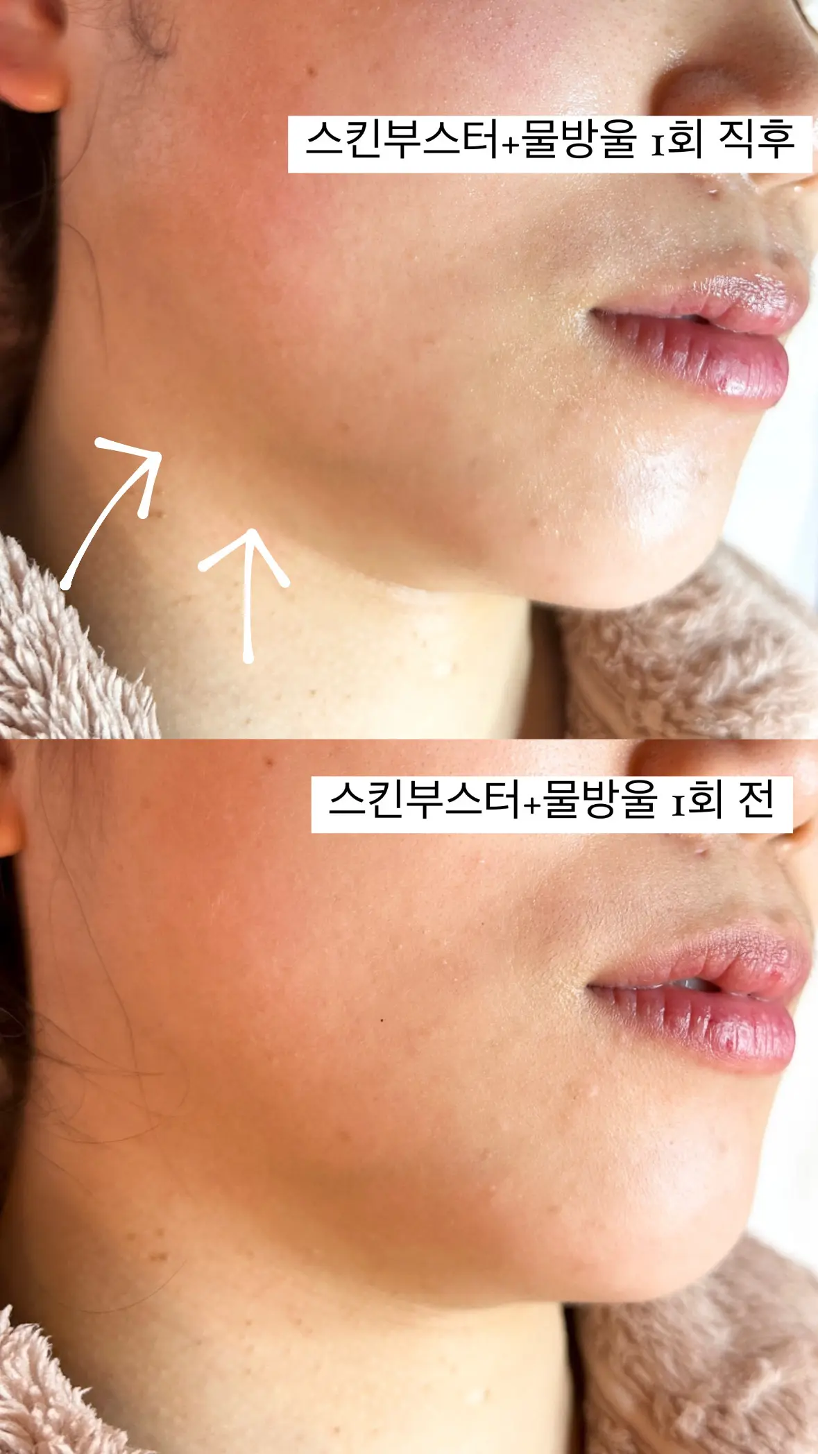 이미지 7