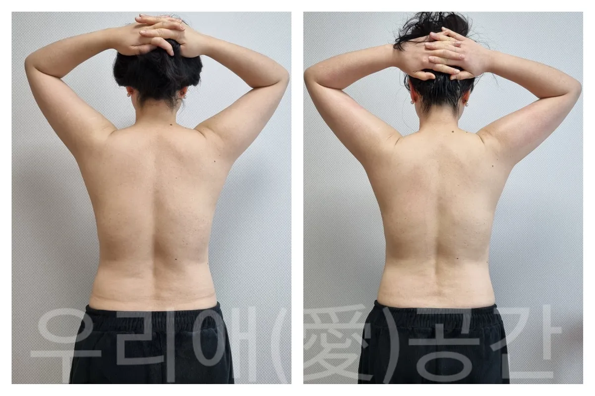 이미지 10