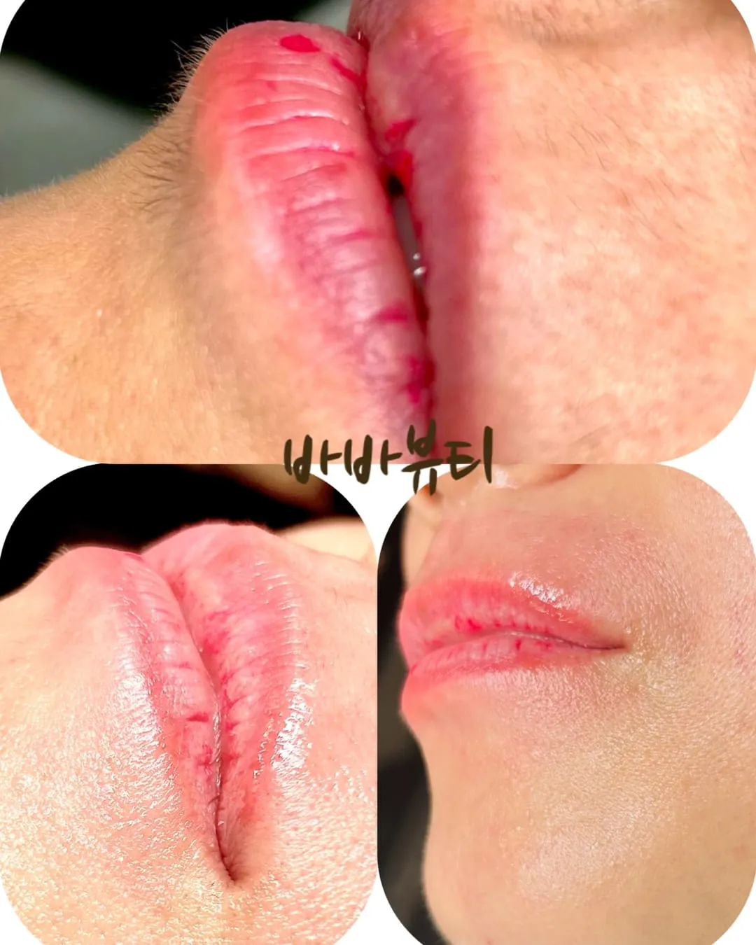 이미지 5