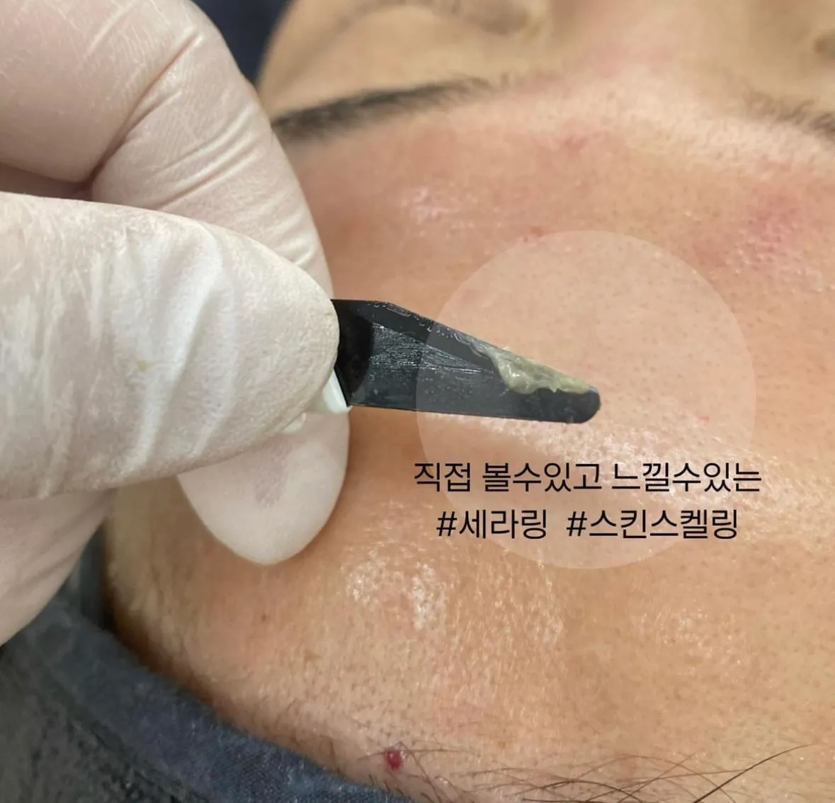 이미지 6