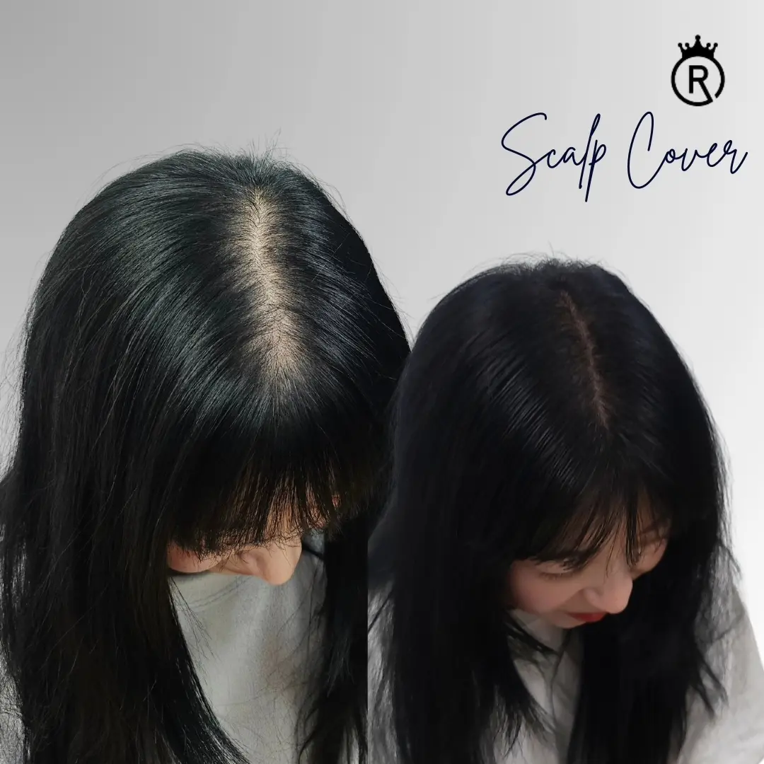 이미지 5