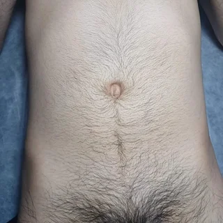 브라질리언