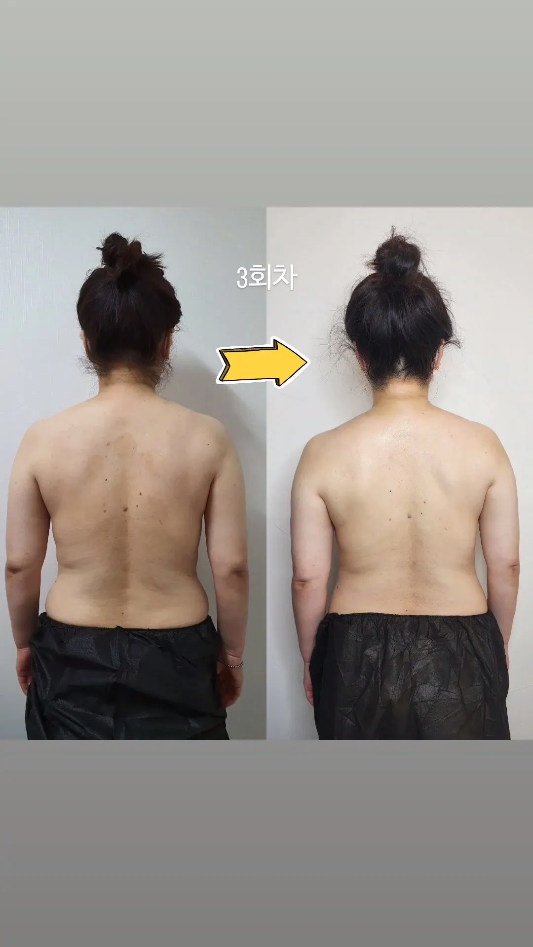 이미지 5