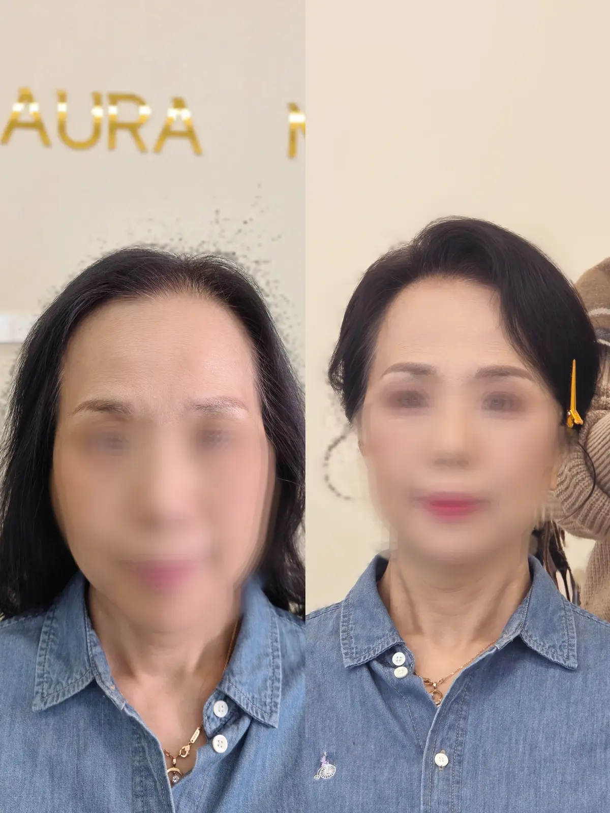 이미지 20