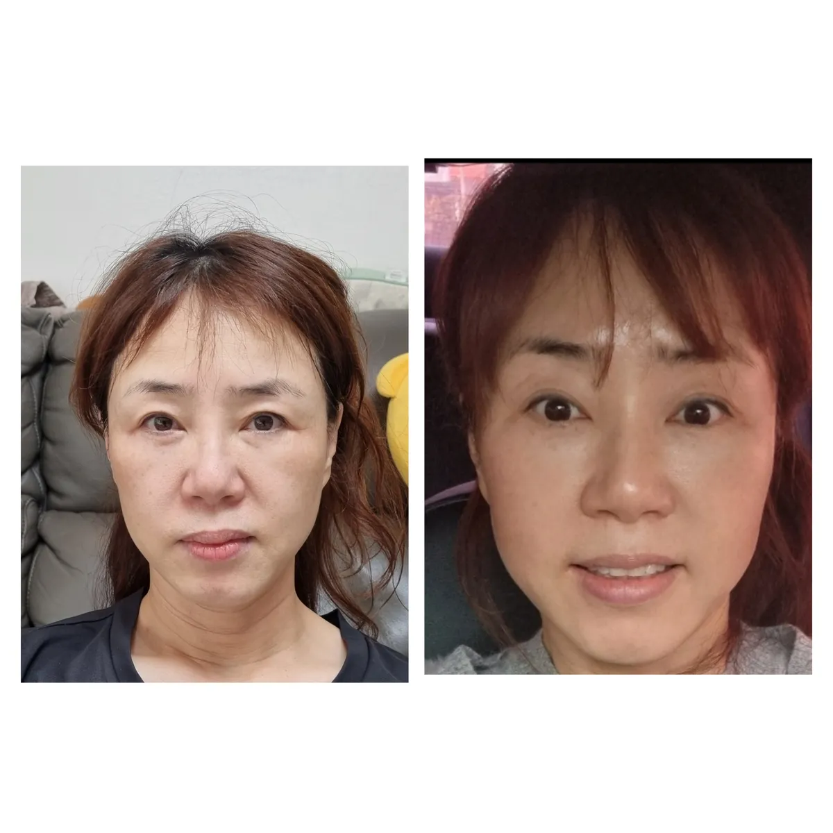 이미지 8
