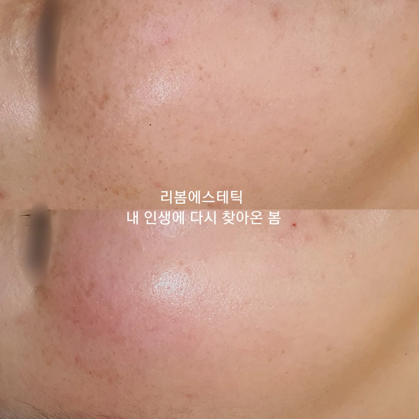 이미지 6