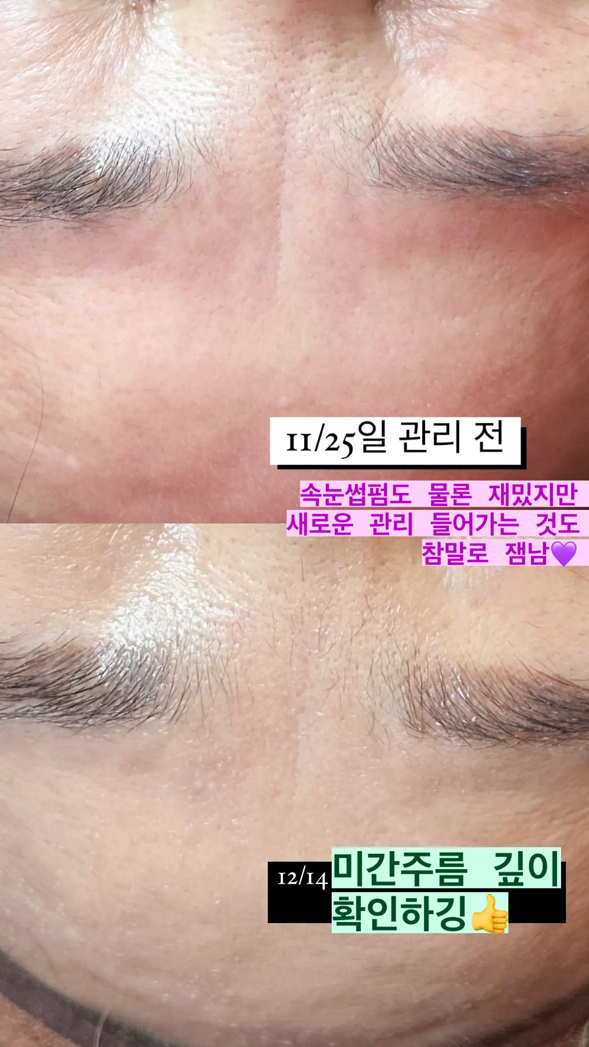 이미지 12