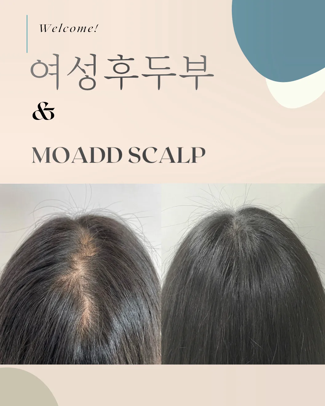 이미지 10