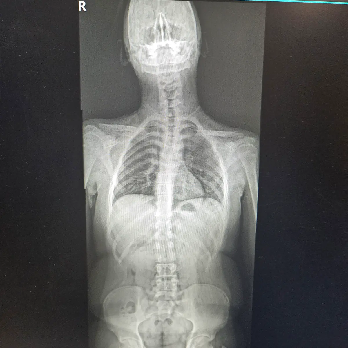 이미지 4