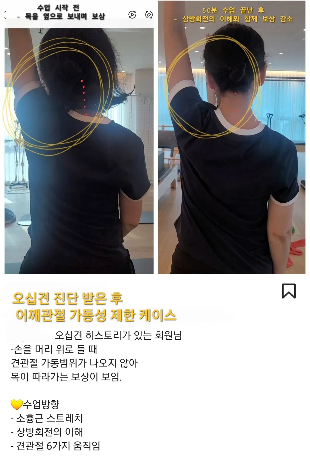 이미지 2