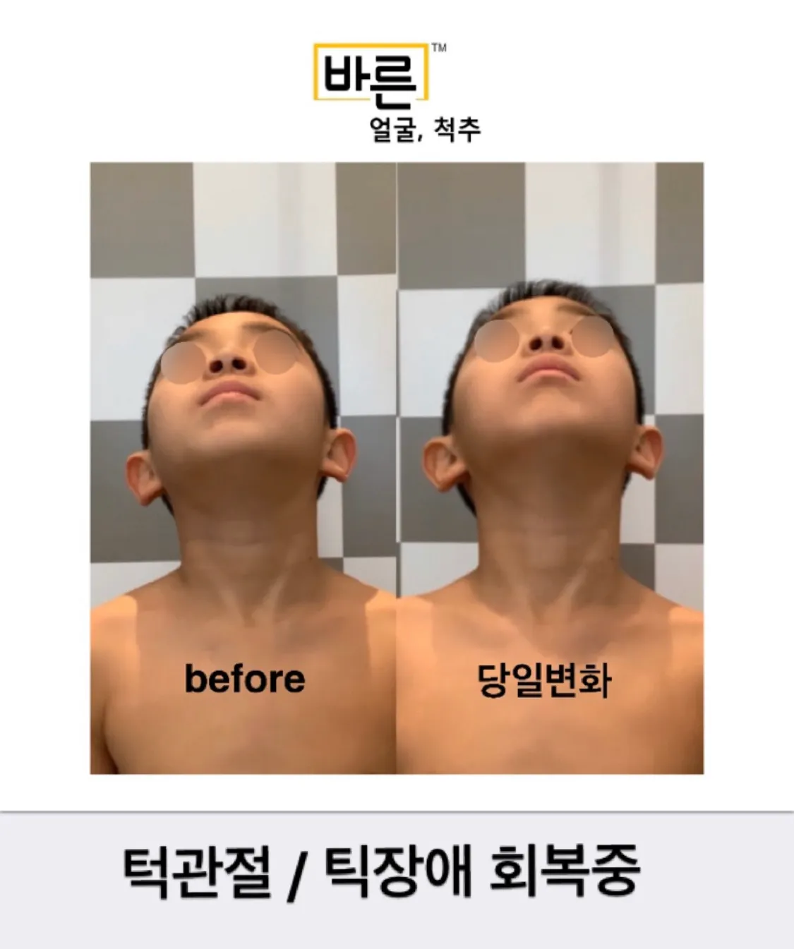 이미지 10