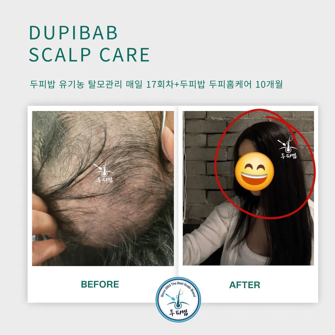 이미지 7