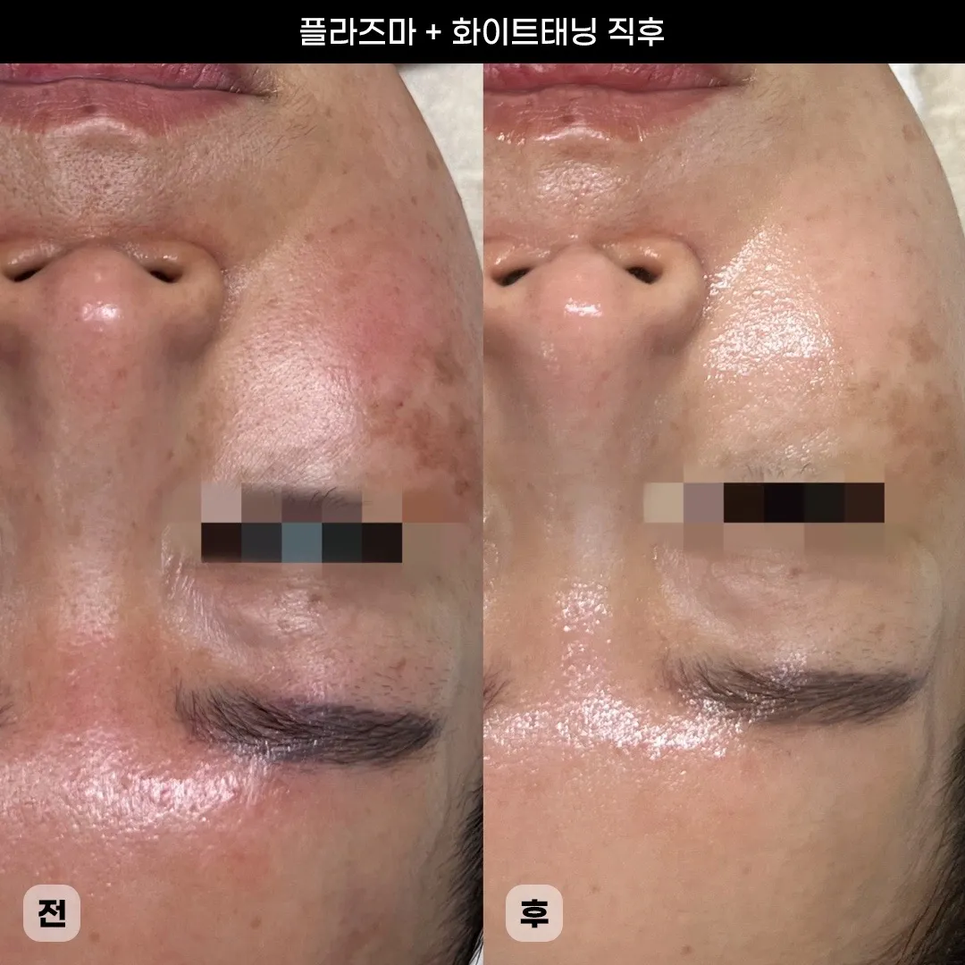 이미지 6