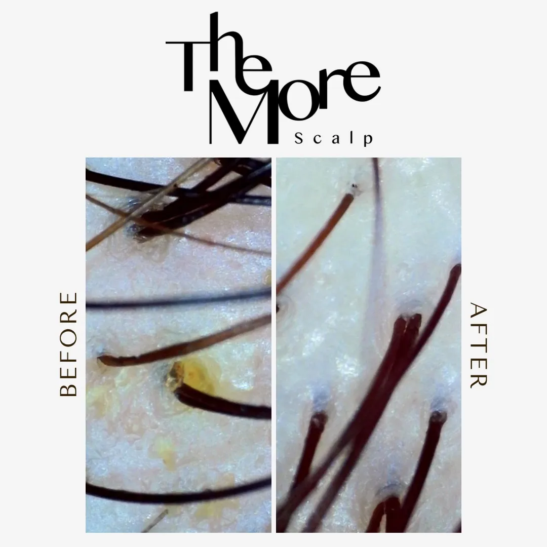 이미지 7