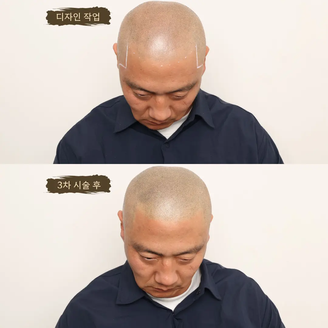 이미지 10