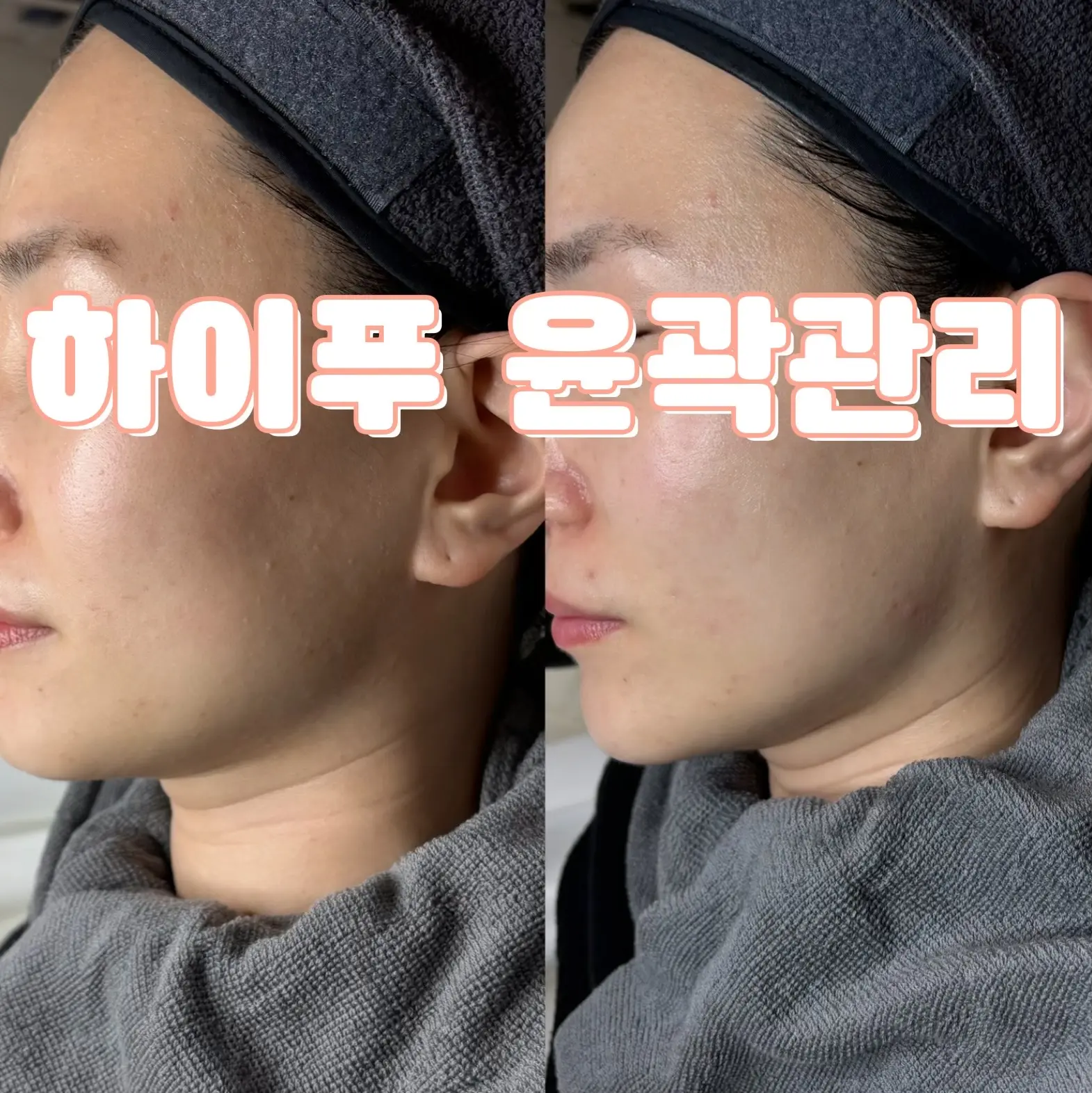 이미지 10