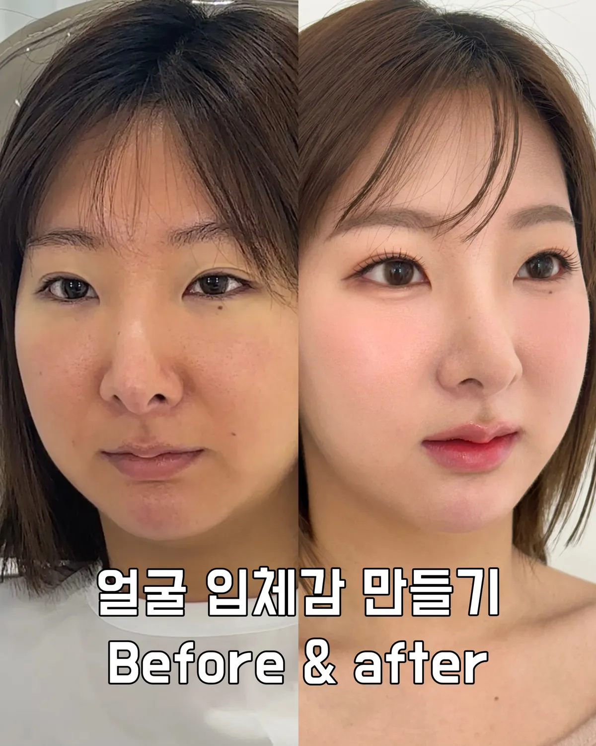 이미지 3